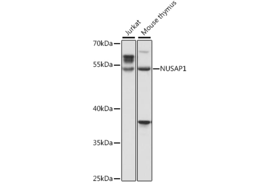 Western Blot - Anti-NUSAP Antibody (A90166) - Antibodies.com