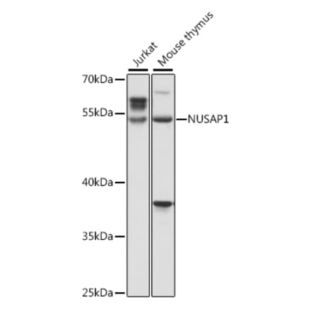 Western Blot - Anti-NUSAP Antibody (A90166) - Antibodies.com