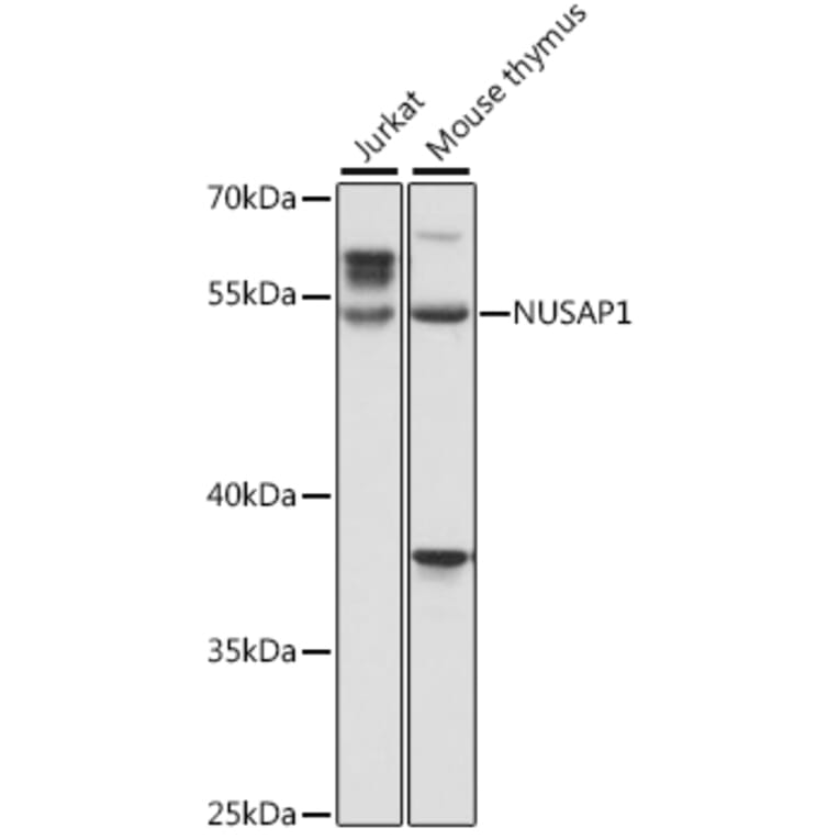 Western Blot - Anti-NUSAP Antibody (A90166) - Antibodies.com