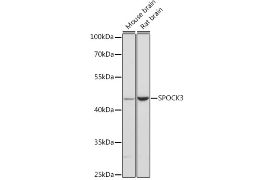 Western Blot - Anti-SPOCK3 Antibody (A90167) - Antibodies.com