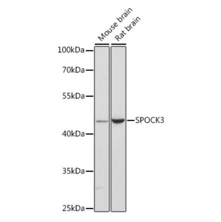 Western Blot - Anti-SPOCK3 Antibody (A90167) - Antibodies.com