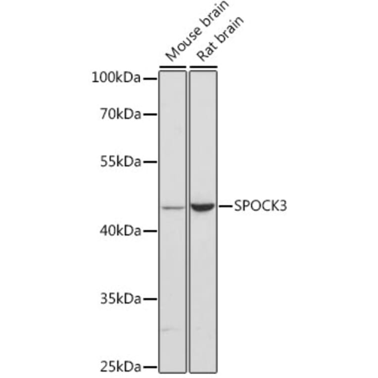 Western Blot - Anti-SPOCK3 Antibody (A90167) - Antibodies.com