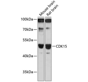 Western Blot - Anti-CDK15 Antibody (A90168) - Antibodies.com