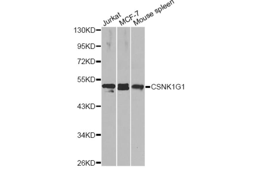 Western Blot - Anti-CSNK1G1 Antibody (A14133) - Antibodies.com