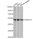Western Blot - Anti-CSNK1G1 Antibody (A14133) - Antibodies.com