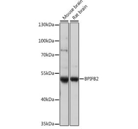 Western Blot - Anti-BPIFB2 Antibody (A90171) - Antibodies.com