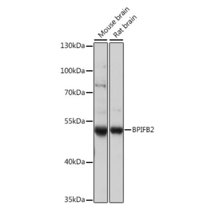 Western Blot - Anti-BPIFB2 Antibody (A90171) - Antibodies.com