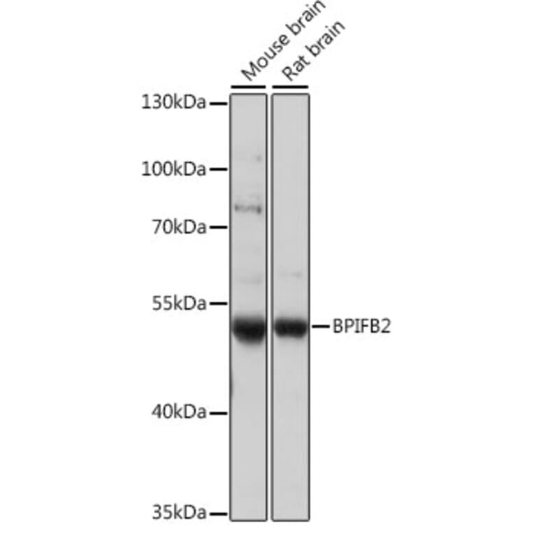 Western Blot - Anti-BPIFB2 Antibody (A90171) - Antibodies.com