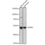 Western Blot - Anti-BPIFB2 Antibody (A90171) - Antibodies.com