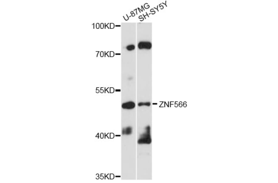 Western Blot - Anti-ZNF566 Antibody (A14432) - Antibodies.com