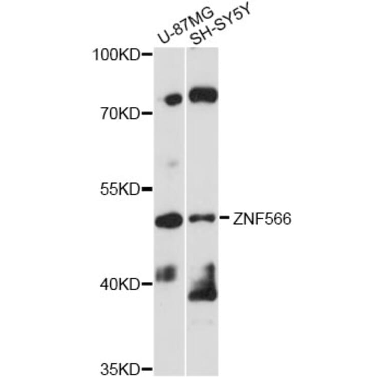 Western Blot - Anti-ZNF566 Antibody (A14432) - Antibodies.com