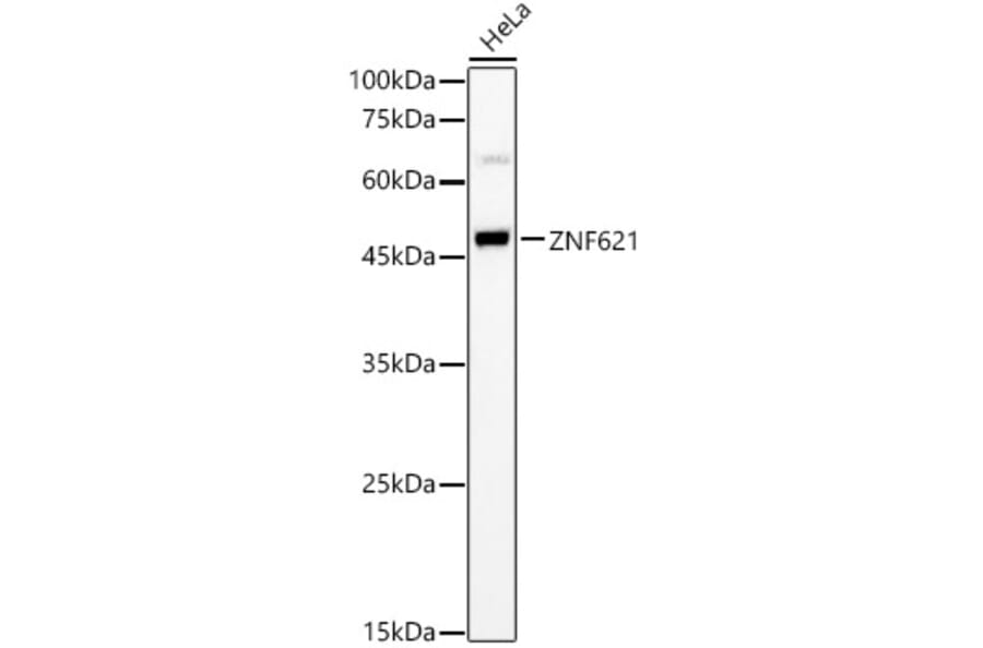 Western Blot - Anti-ZNF621 Antibody (A90173) - Antibodies.com