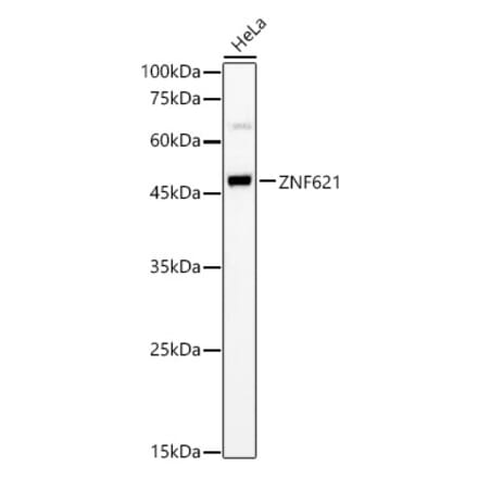 Western Blot - Anti-ZNF621 Antibody (A90173) - Antibodies.com
