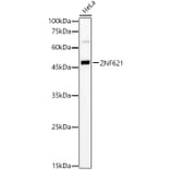 Western Blot - Anti-ZNF621 Antibody (A90173) - Antibodies.com