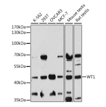 Western Blot - Anti-Wilms Tumor Protein Antibody (A90176) - Antibodies.com