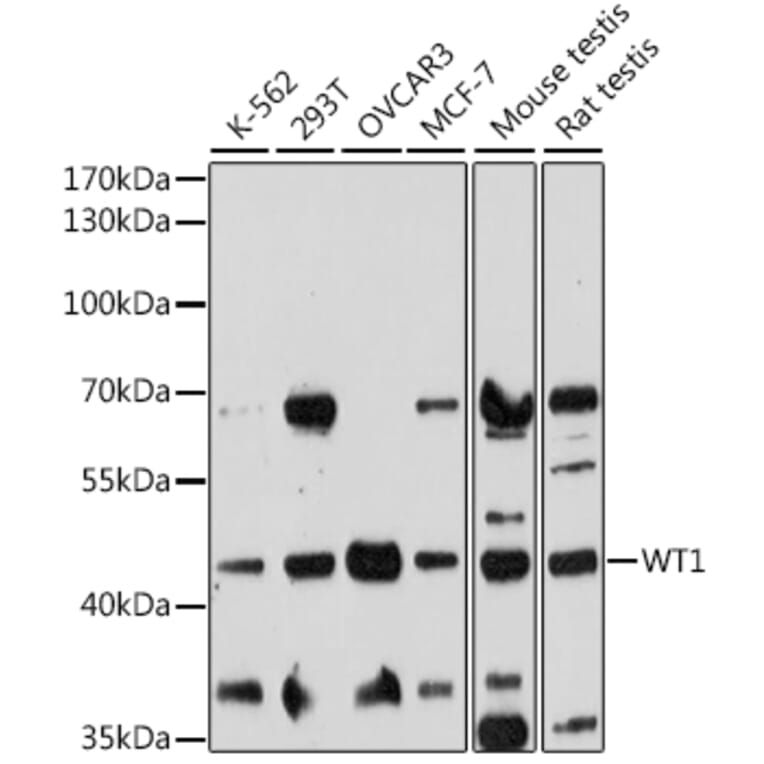 Western Blot - Anti-Wilms Tumor Protein Antibody (A90176) - Antibodies.com