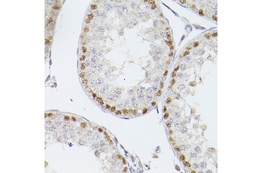 Immunohistochemistry - Anti-Wilms Tumor Protein Antibody (A90176) - Antibodies.com