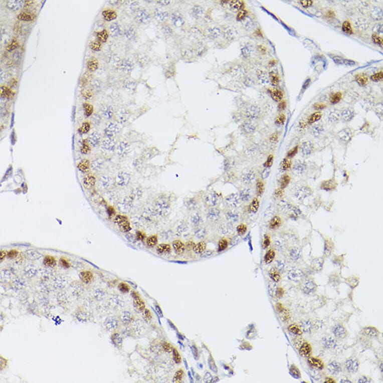 Immunohistochemistry - Anti-Wilms Tumor Protein Antibody (A90176) - Antibodies.com