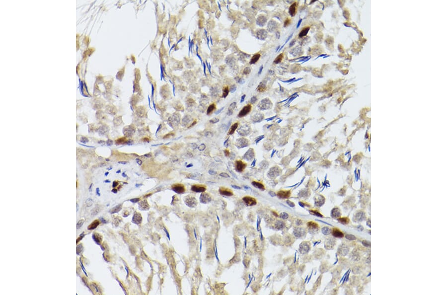 Immunohistochemistry - Anti-Wilms Tumor Protein Antibody (A90176) - Antibodies.com