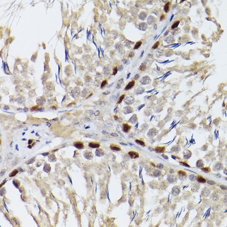 Immunohistochemistry - Anti-Wilms Tumor Protein Antibody (A90176) - Antibodies.com