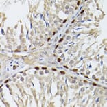 Immunohistochemistry - Anti-Wilms Tumor Protein Antibody (A90176) - Antibodies.com