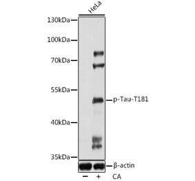 Western Blot - Anti-Tau (phospho Thr181) Antibody (A90177) - Antibodies.com