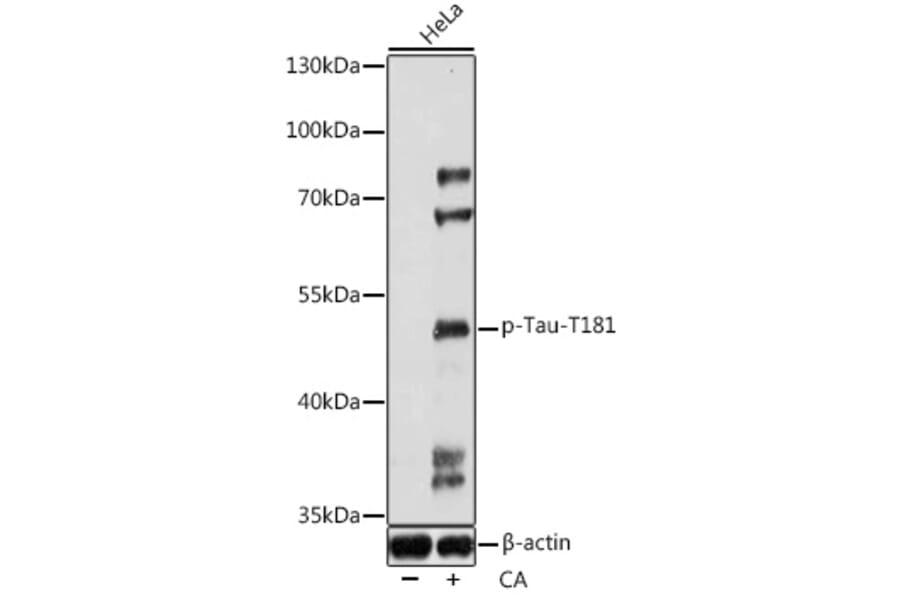 Western Blot - Anti-Tau (phospho Thr181) Antibody (A90177) - Antibodies.com