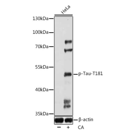 Western Blot - Anti-Tau (phospho Thr181) Antibody (A90177) - Antibodies.com