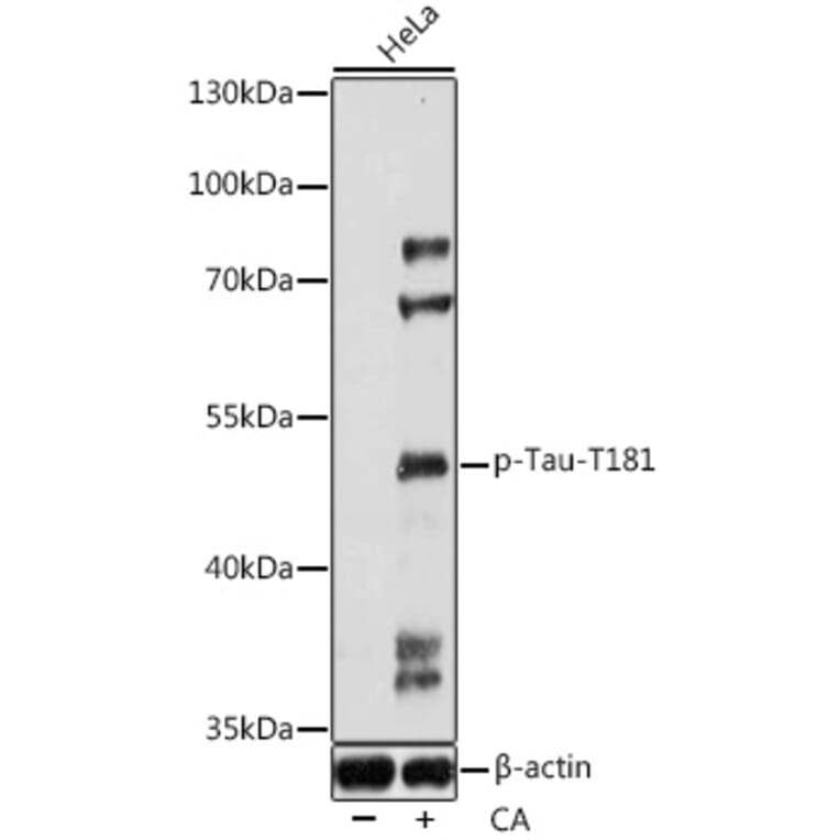 Western Blot - Anti-Tau (phospho Thr181) Antibody (A90177) - Antibodies.com