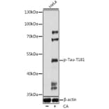 Western Blot - Anti-Tau (phospho Thr181) Antibody (A90177) - Antibodies.com
