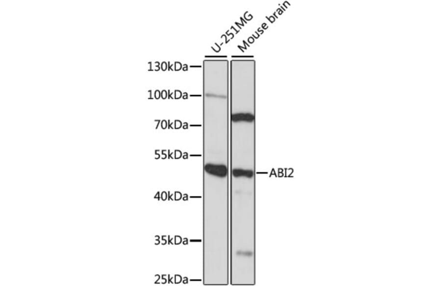Western Blot - Anti-ABI2 Antibody (A90178) - Antibodies.com