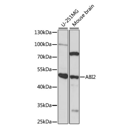 Western Blot - Anti-ABI2 Antibody (A90178) - Antibodies.com