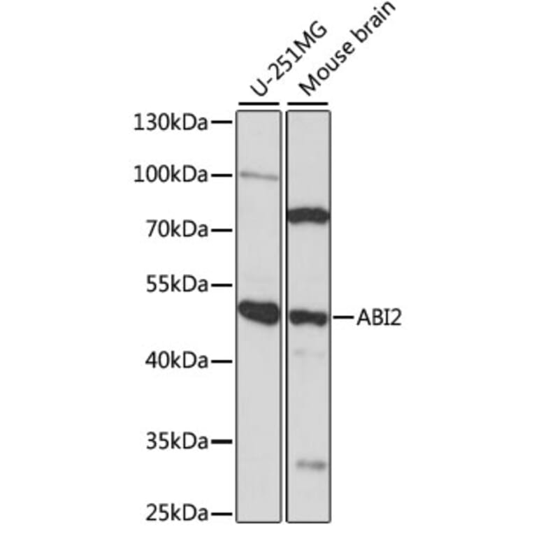 Western Blot - Anti-ABI2 Antibody (A90178) - Antibodies.com