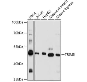 Western Blot - Anti-TRIM5 alpha Antibody (A90179) - Antibodies.com