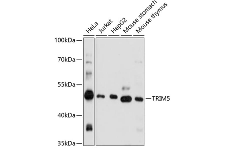 Western Blot - Anti-TRIM5 alpha Antibody (A90179) - Antibodies.com