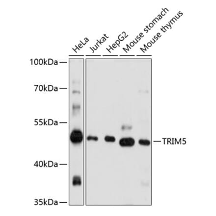 Western Blot - Anti-TRIM5 alpha Antibody (A90179) - Antibodies.com