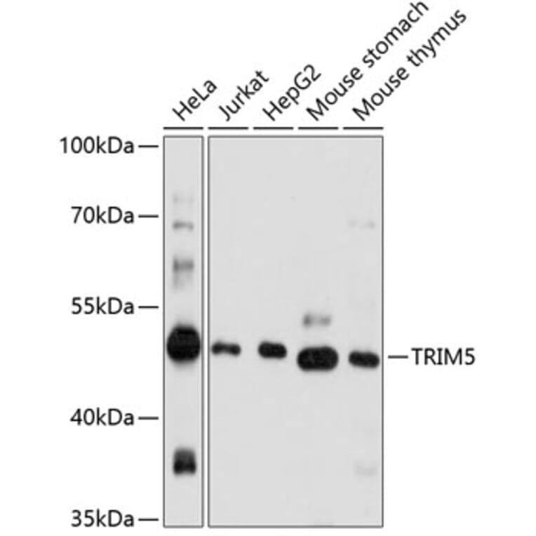 Western Blot - Anti-TRIM5 alpha Antibody (A90179) - Antibodies.com