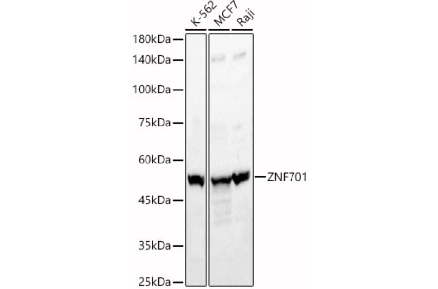 Western Blot - Anti-ZNF701 Antibody (A90180) - Antibodies.com