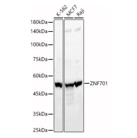 Western Blot - Anti-ZNF701 Antibody (A90180) - Antibodies.com