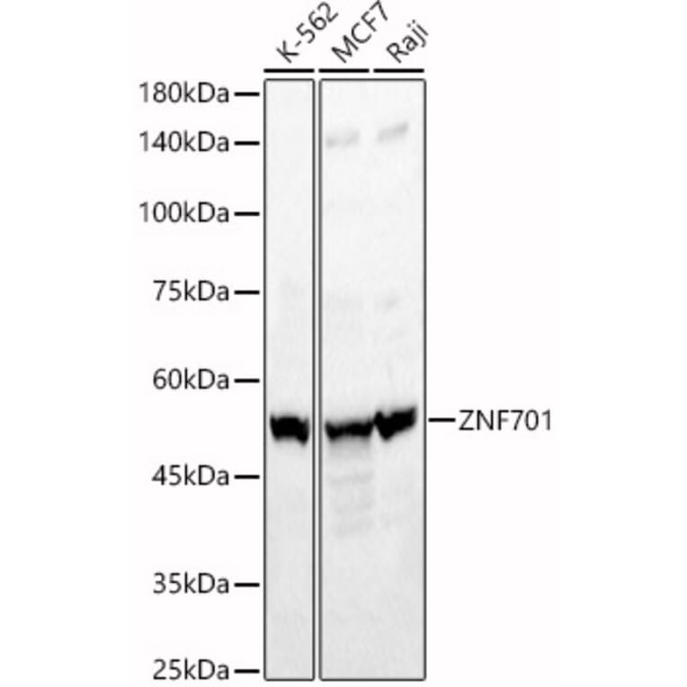 Western Blot - Anti-ZNF701 Antibody (A90180) - Antibodies.com