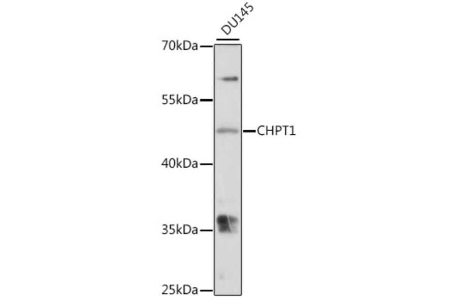 Western Blot - Anti-CHPT1/CPT1 Antibody (A90181) - Antibodies.com