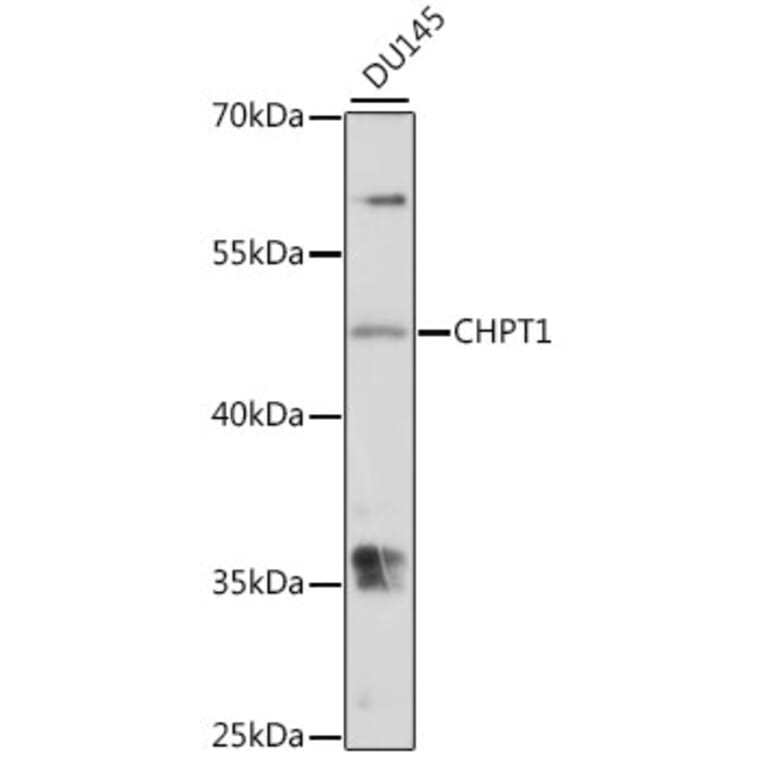 Western Blot - Anti-CHPT1/CPT1 Antibody (A90181) - Antibodies.com