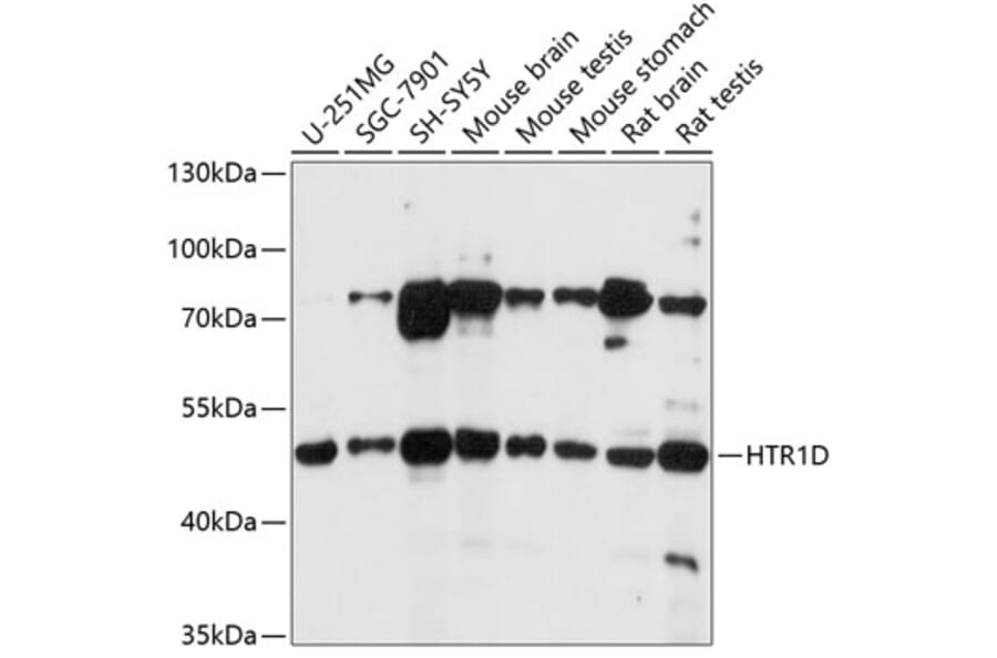 Western Blot - Anti-5HT1D Receptor Antibody (A90183) - Antibodies.com