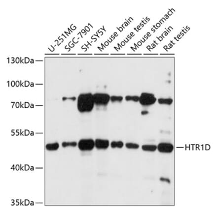 Western Blot - Anti-5HT1D Receptor Antibody (A90183) - Antibodies.com