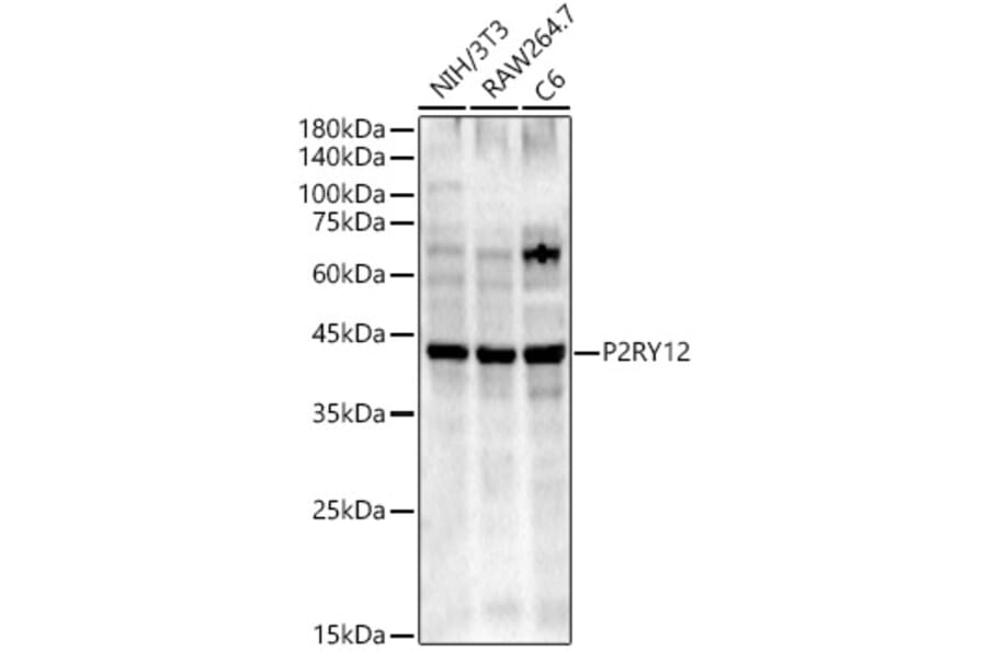 Western Blot - Anti-P2Y12 Antibody (A90184) - Antibodies.com