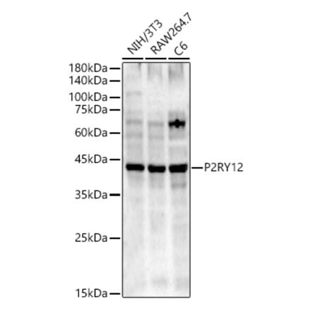 Western Blot - Anti-P2Y12 Antibody (A90184) - Antibodies.com