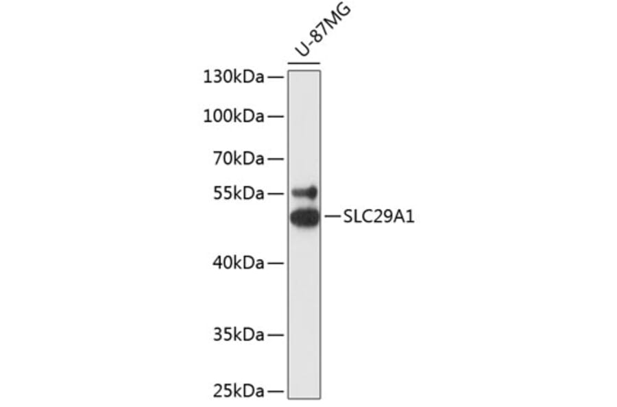Western Blot - Anti-ENT1 Antibody (A90186) - Antibodies.com
