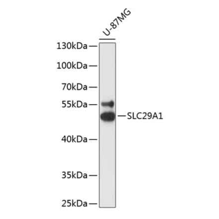 Western Blot - Anti-ENT1 Antibody (A90186) - Antibodies.com