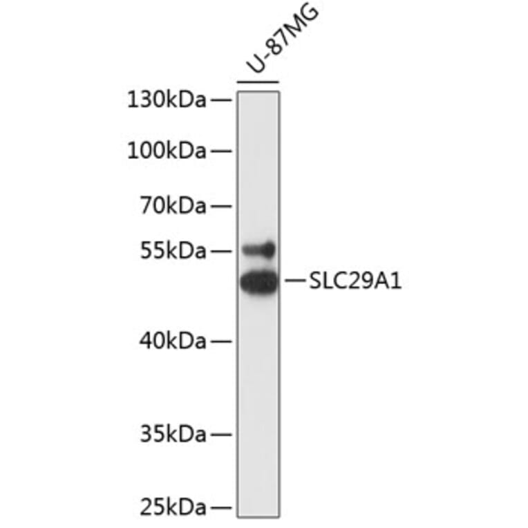 Western Blot - Anti-ENT1 Antibody (A90186) - Antibodies.com