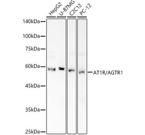 Western Blot - Anti-Angiotensin II Type 1 Receptor Antibody (A90187) - Antibodies.com